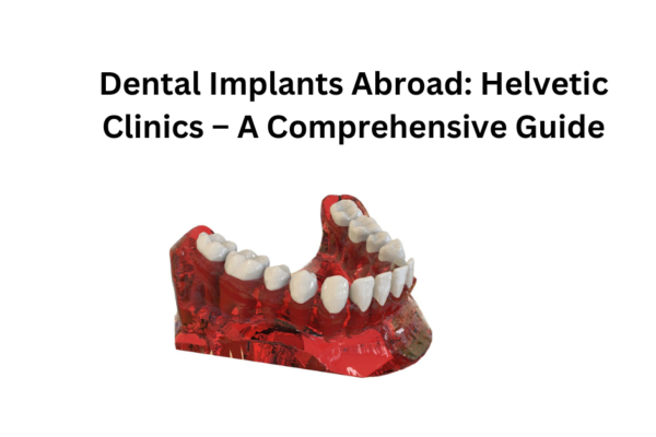 Dental Implants Abroad: Helvetic Clinics