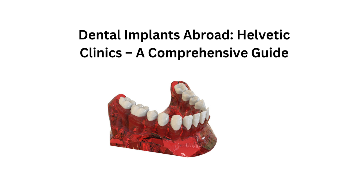 Dental Implants Abroad: Helvetic Clinics